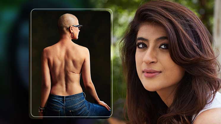 Tahira Kashyap posts a bold picture to create awareness on 