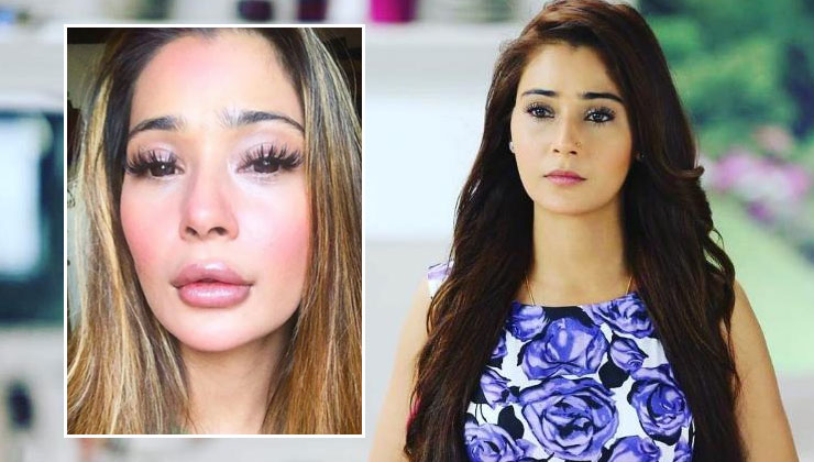 Sara Khan lip surgery